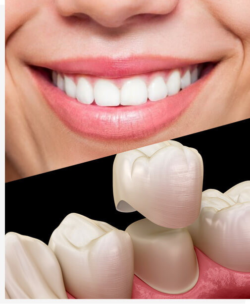 Cosmetic Dentistry